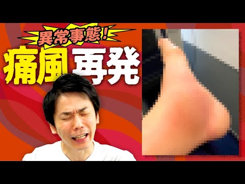 【痛風再発】かまいたち濱家の足に異常事態発生!
