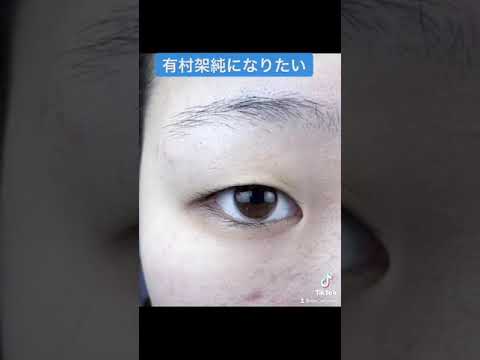 【二重埋没】二重の整形で有村架純になった女性 #shorts