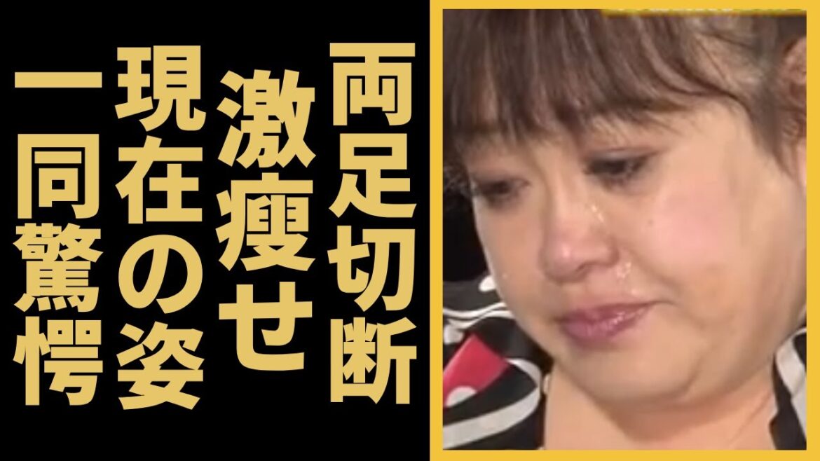 森公美子に降り掛かった悲劇の真相や現在の両足切断の姿に涙が止まらない…オペラ歌手「モリクミ」が交通事故で頭部を強打、12年間も言葉を話せず…車椅子生活を介護し続ける姿に涙が溢れる…