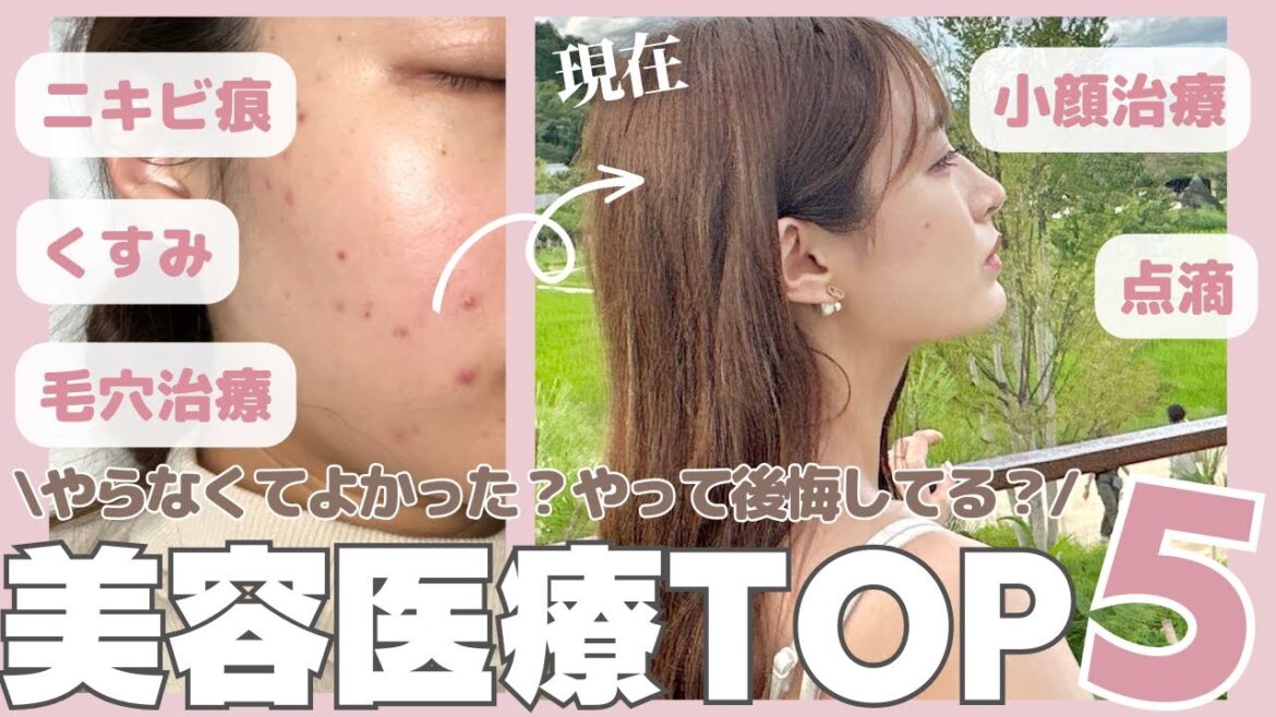 【美肌・リフトアップ】個人的にやって後悔した美容医療を紹介🥺【美容課金】