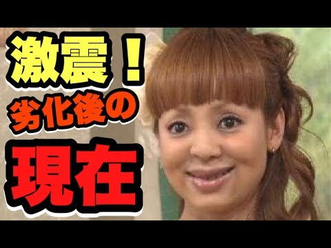 【壮絶な劣化】 別人と化してしまった 有名人の恐るべき現在