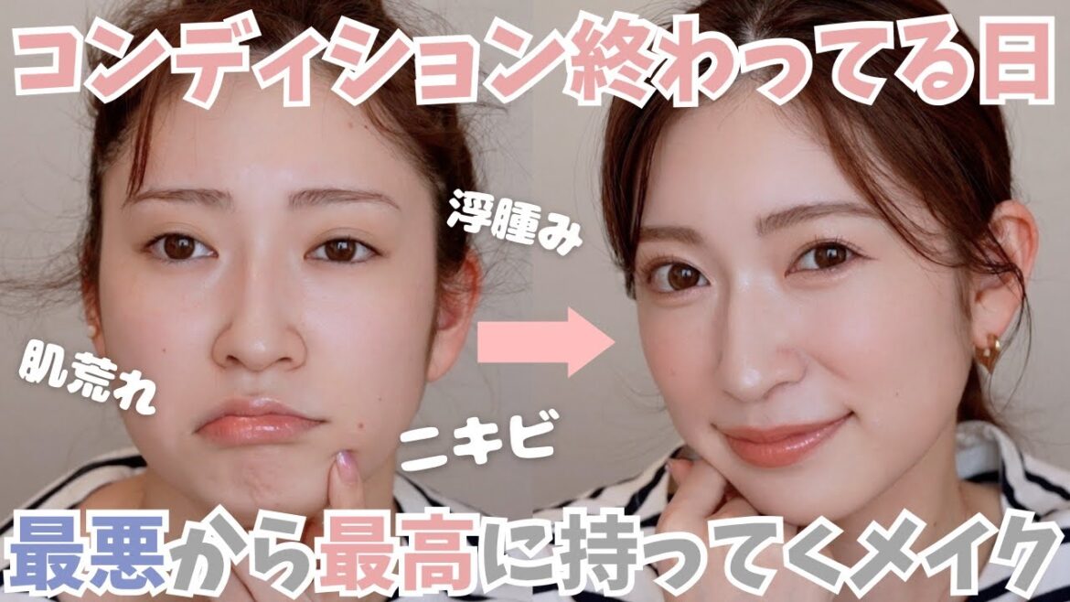 【絶賛肌荒れ中】最悪コンディション→「今日綺麗だね」褒められるスキンケア&メイクルーティン【クマ/ニキビ/くすみカバー🙅♀】