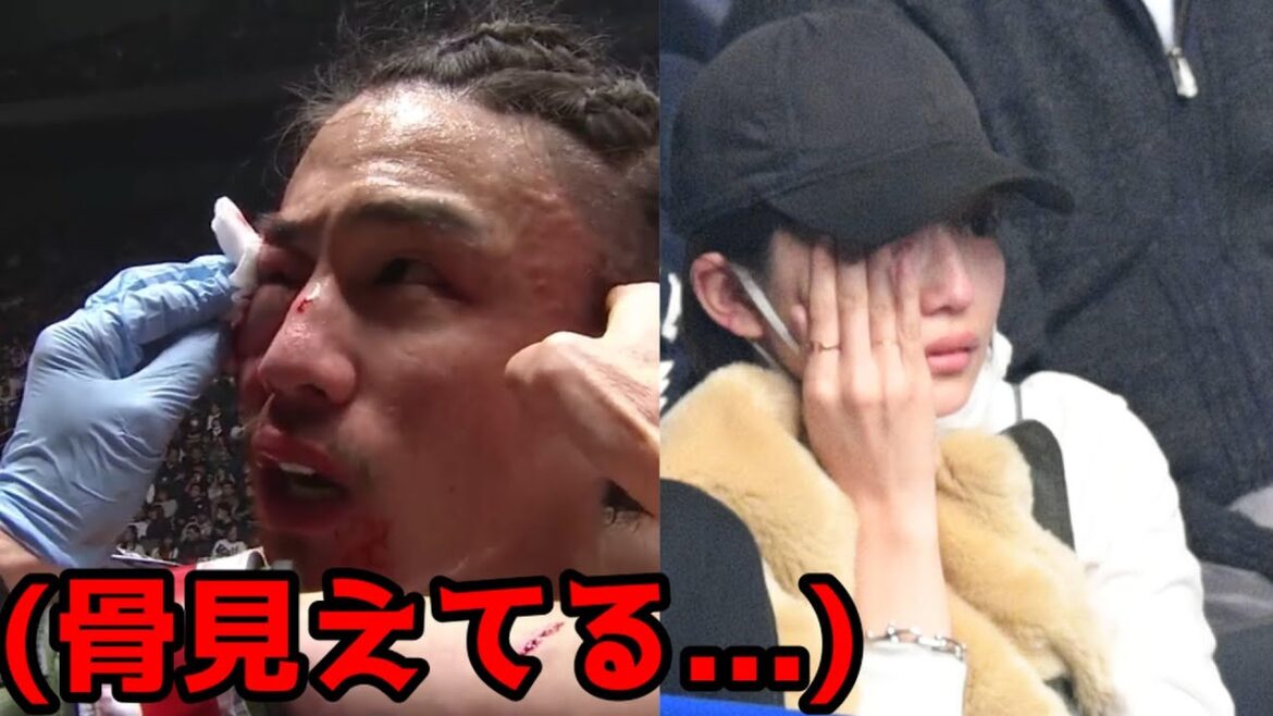【川口春奈の彼氏】矢地祐介が大流血で骨が飛び出る【RIZIN切り抜き】