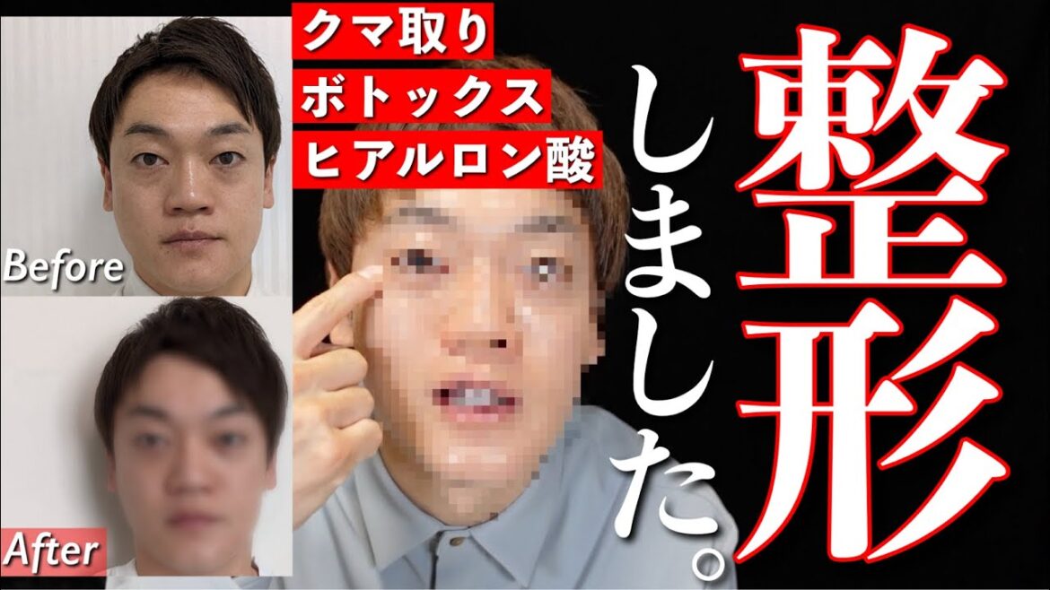 98万円かけて整形しました。