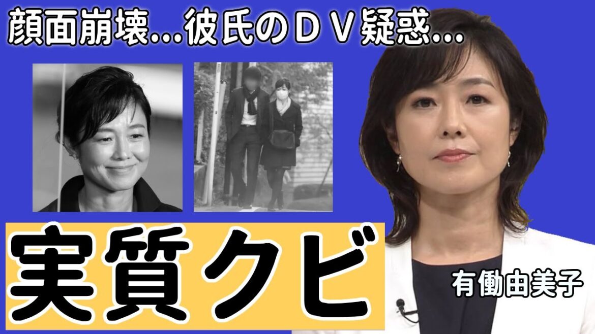 有働由美子アナの降板が実質クビの真相…突然襲った大怪我で顔面崩壊した現在に一同驚愕…!暴露された熱愛彼氏のDV疑惑の実態に驚きを隠さない…