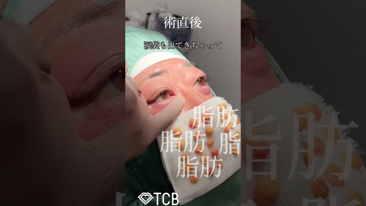 【クマ取り】#shorts