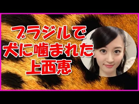 【NMB48】ブラジルで犬に噛まれた上西恵