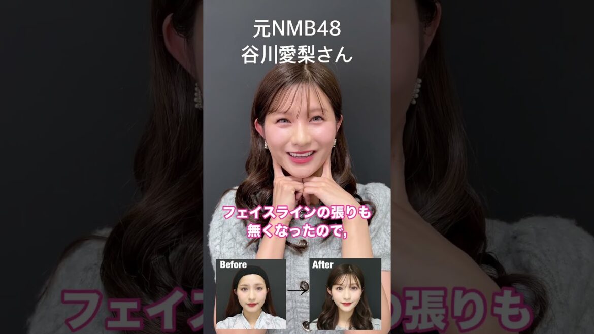 元NMB48谷川愛梨さんも卵型の小顔に #糸リフト #小顔
