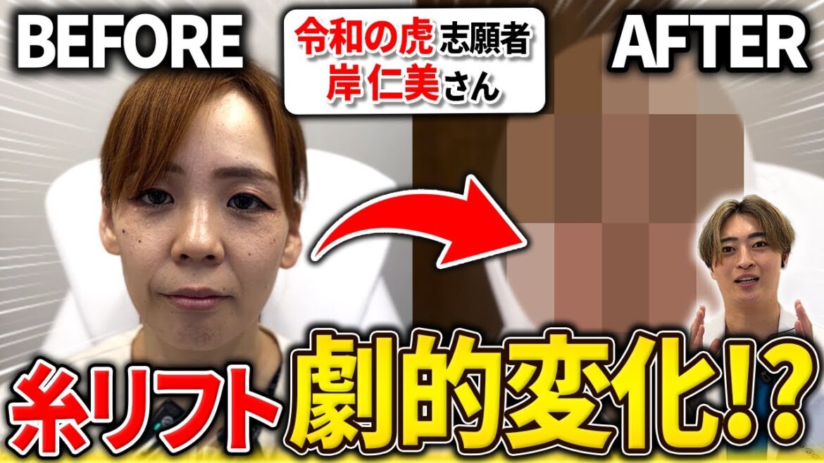 【令和の虎】【糸リフト】志願者の岸仁美さんの施術風景を大公開!