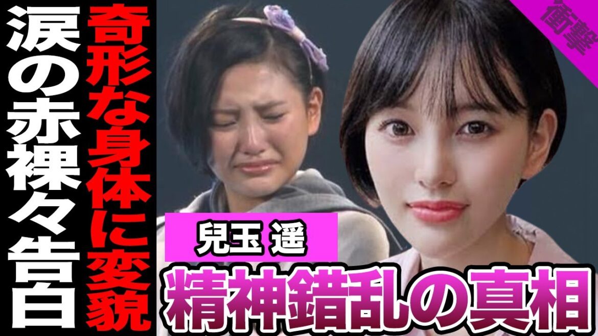 兒玉遥が壮絶な現状を涙ながらに告白…過食嘔吐の常習状態、コンプレックスが爆発で1,000万円規模の顔面課金、制御できない精神錯乱状態に絶句【芸能・アイドル・HKT48】