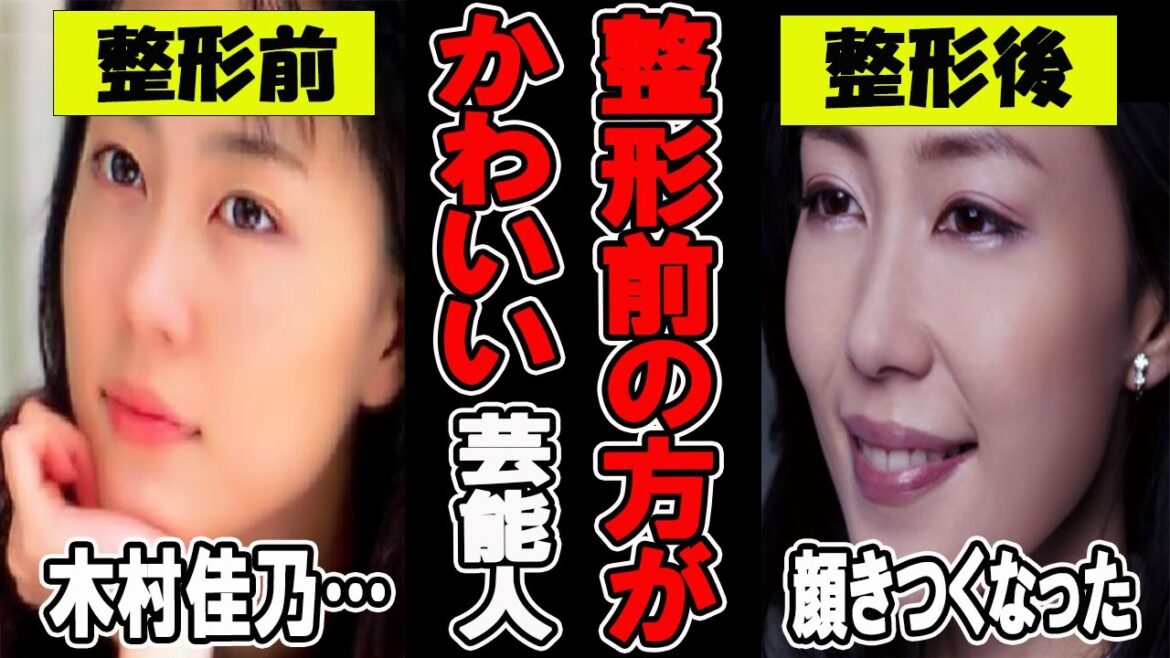 【がるちゃん芸能人】衝撃!整形前のほうが可愛い芸能人