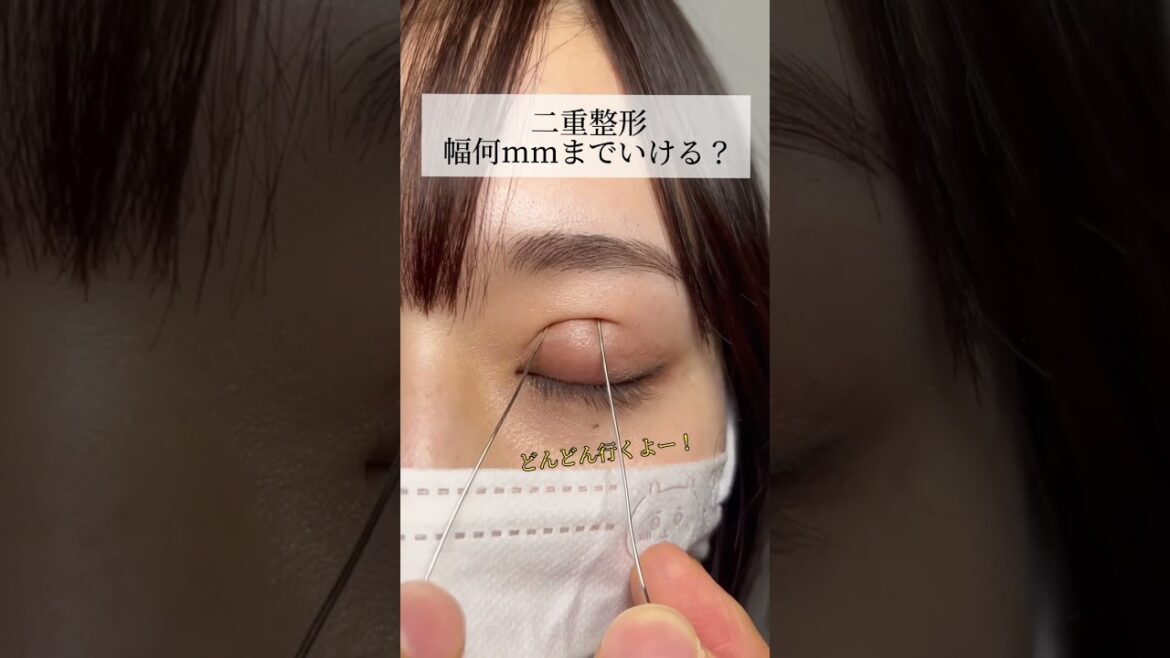 【二重整形】二重整形何mmまでいける?#shorts