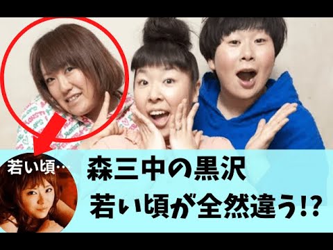 黒沢かずこ 痩せてた頃の写真が可愛すぎる!知られざる過去とは?