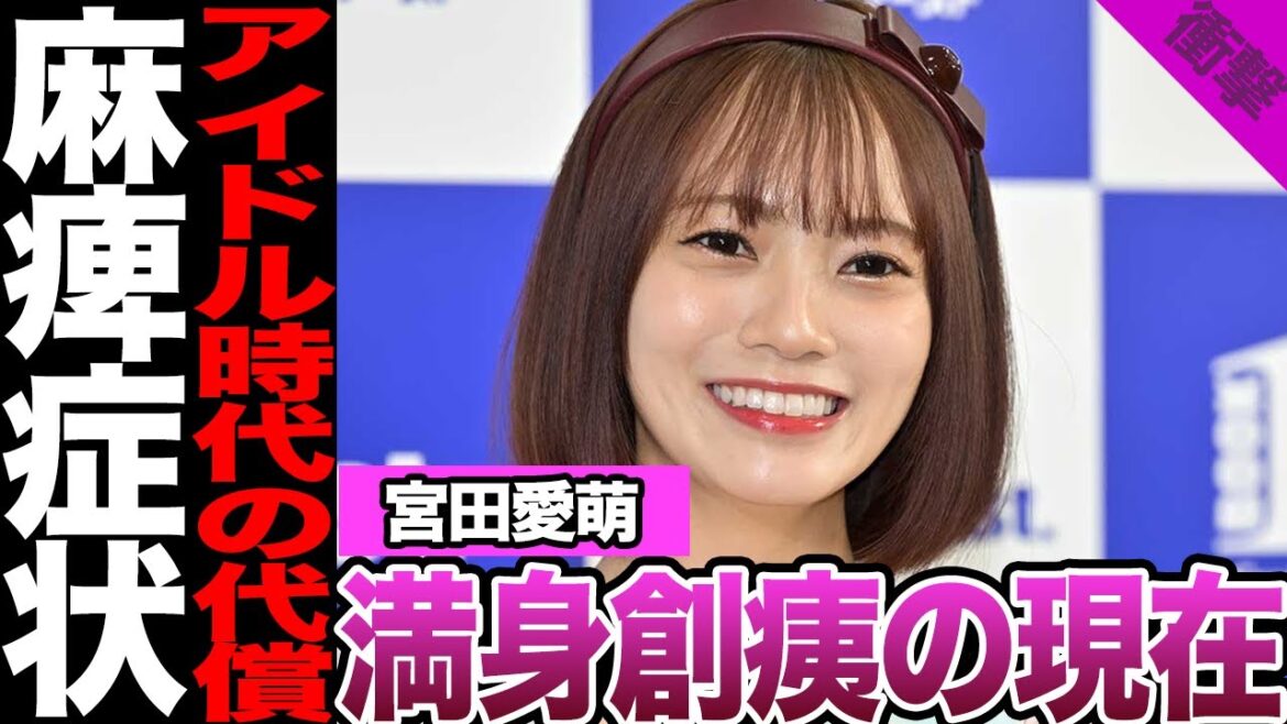 宮田愛萌が明かした満身創痍の現在に言葉を失う…アイドル時代の代償、歩行困難、麻痺症状との闘いに驚きを隠せない!【日向坂46】【アイドル】