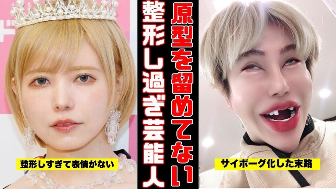 【閲覧注意】整形し過ぎで別人 になってしまった芸能人【ガルちゃん芸能まとめ】