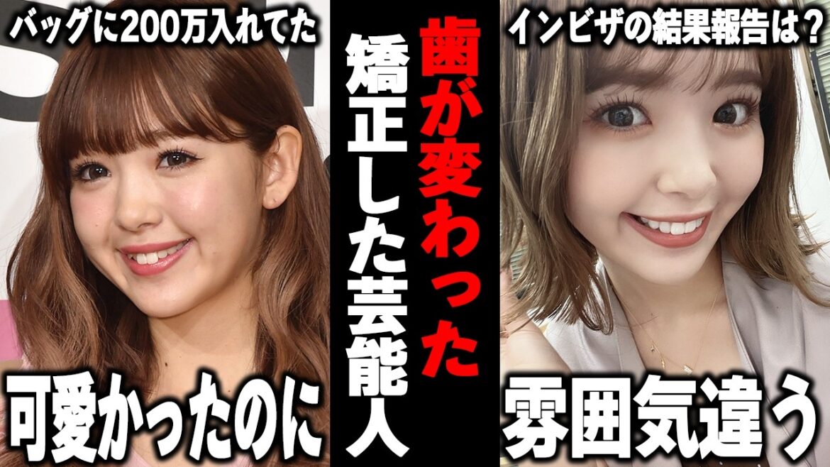 【ガルちゃん芸能】この人もセラミック…!?いつのまにか歯が変わっていた芸能人まとめ!