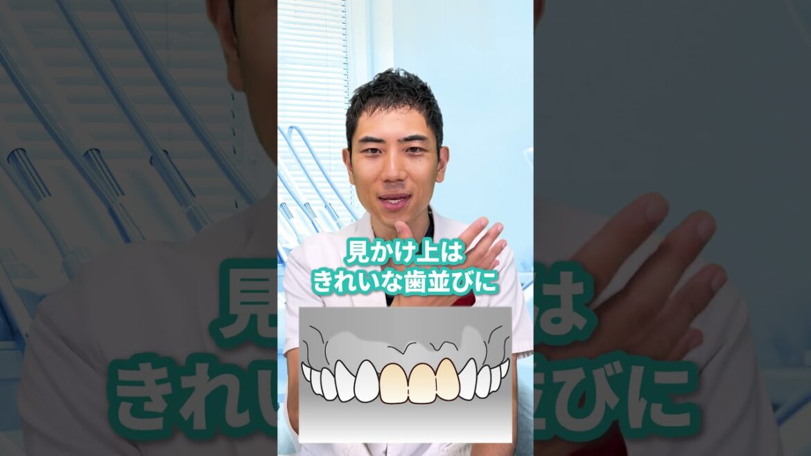 【矯正】イモトアヤコさんの歯並びを考察してみた!!#イモトアヤコ #shotrs