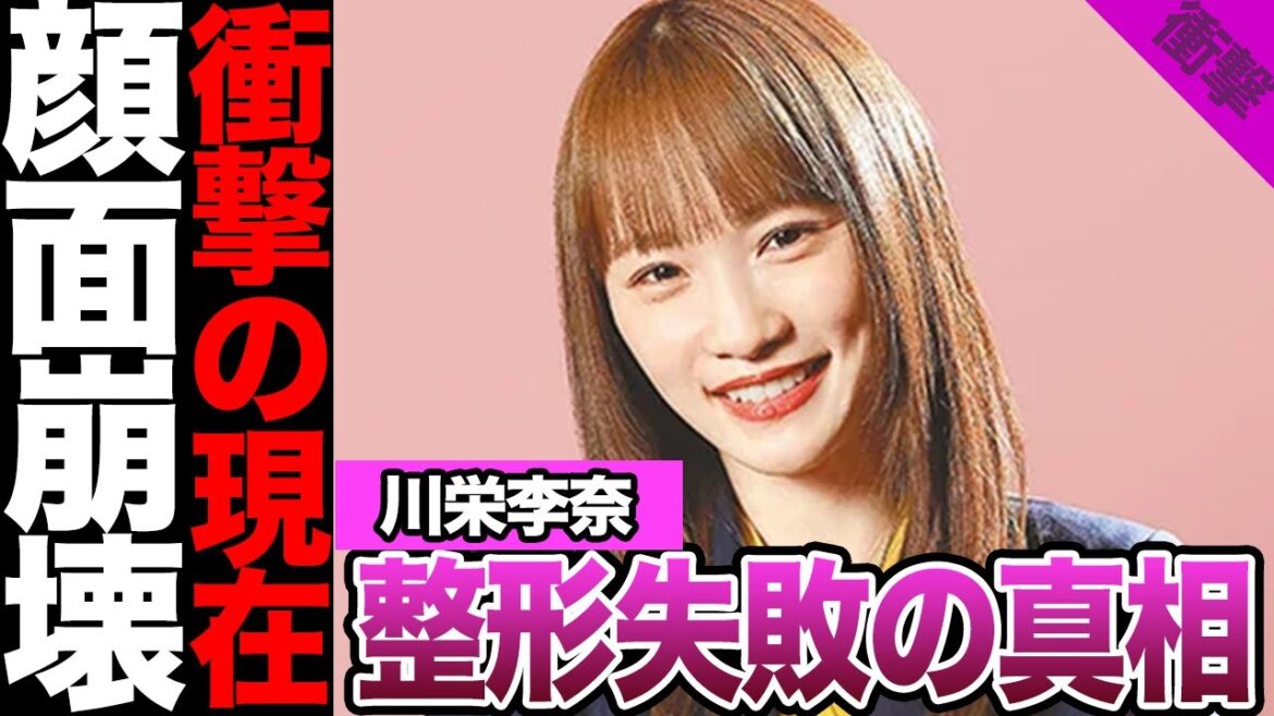 川栄李奈の顔面崩壊に一同絶句….整形失敗により仕事減少で借金地獄の真相がヤバすぎる【アイドル】【乃木坂】