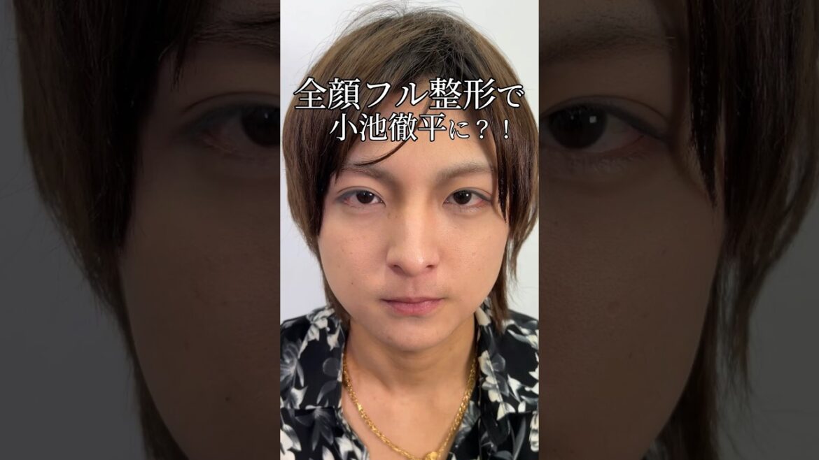 【全顔フル整形】全顔フル整形で小池徹平に?!#shorts