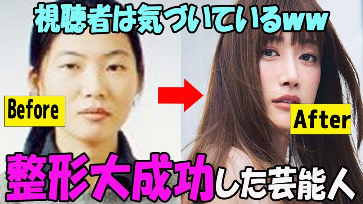 【驚きのビフォーアフター】整形成功したと思う芸能人