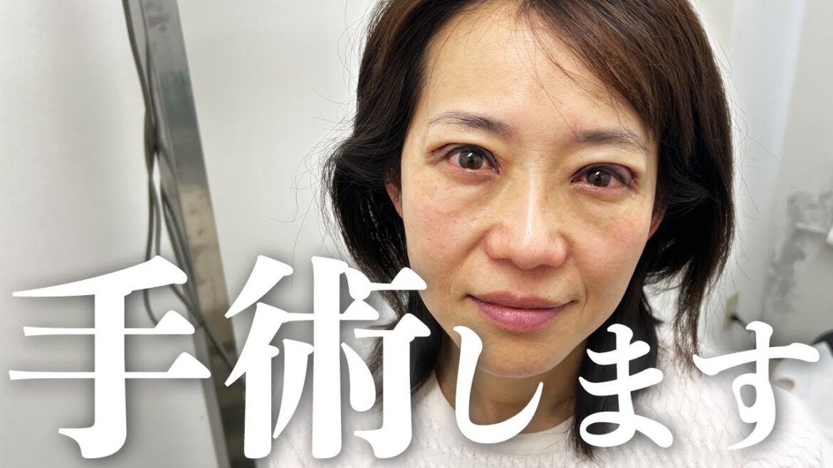 【140万再生‼️同じ悩みを抱えてる人へ】眼瞼下垂で2年以上悩み続け遂に決心!